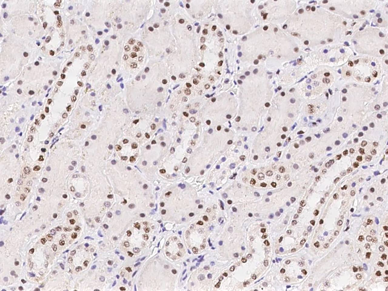 SCAF8/RBM16 Antibody - BSA Free