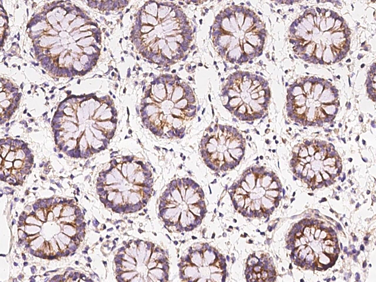 CCDC66 Antibody - BSA Free