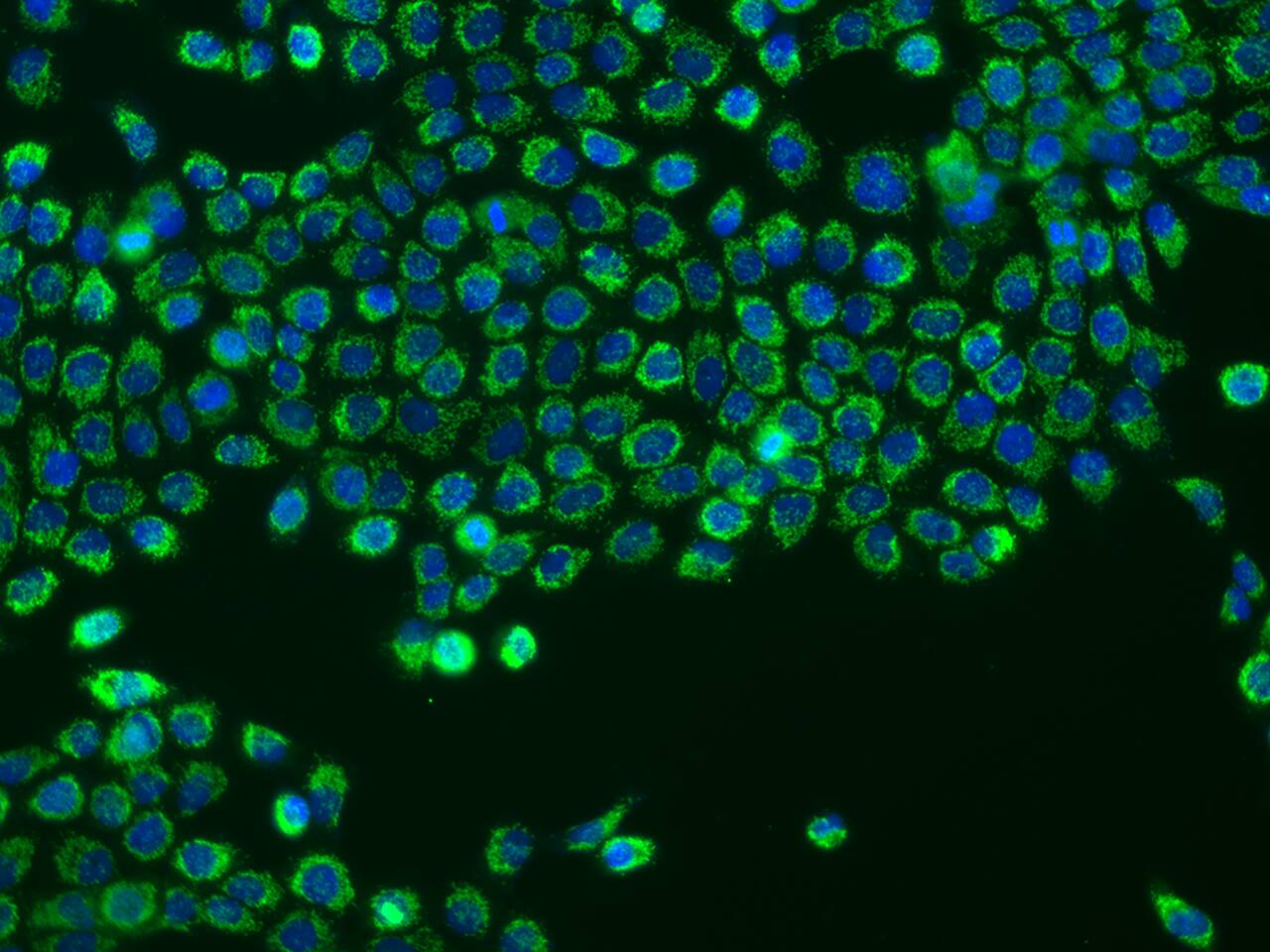 CHCHD10 Antibody - BSA Free