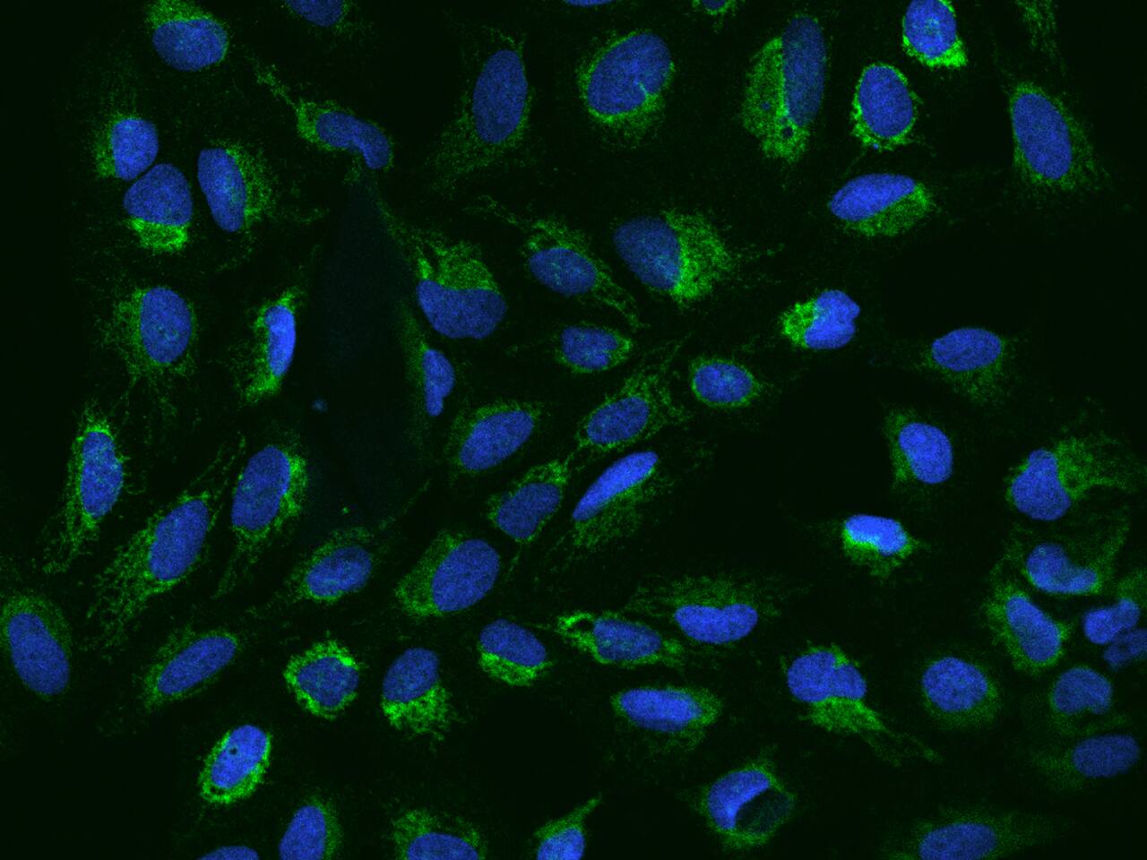 CHCHD5 Antibody - BSA Free
