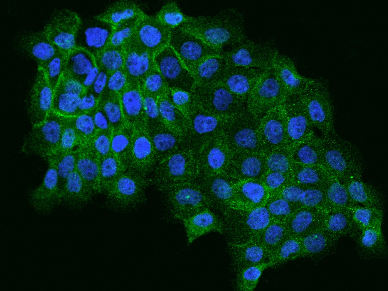 ALS2CR12 Antibody - BSA Free
