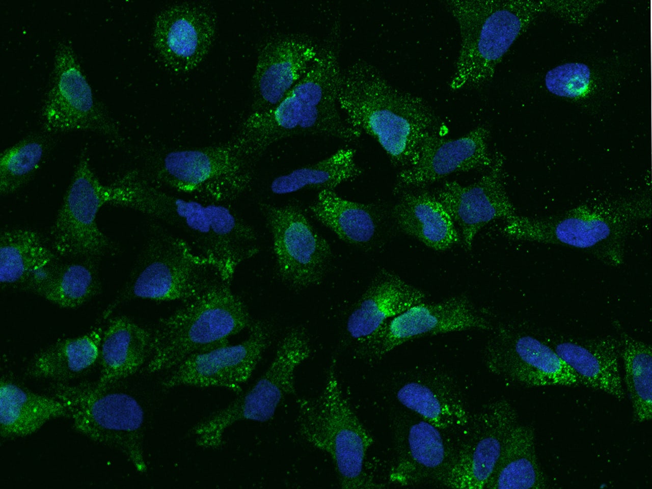 GPR63 Antibody - BSA Free