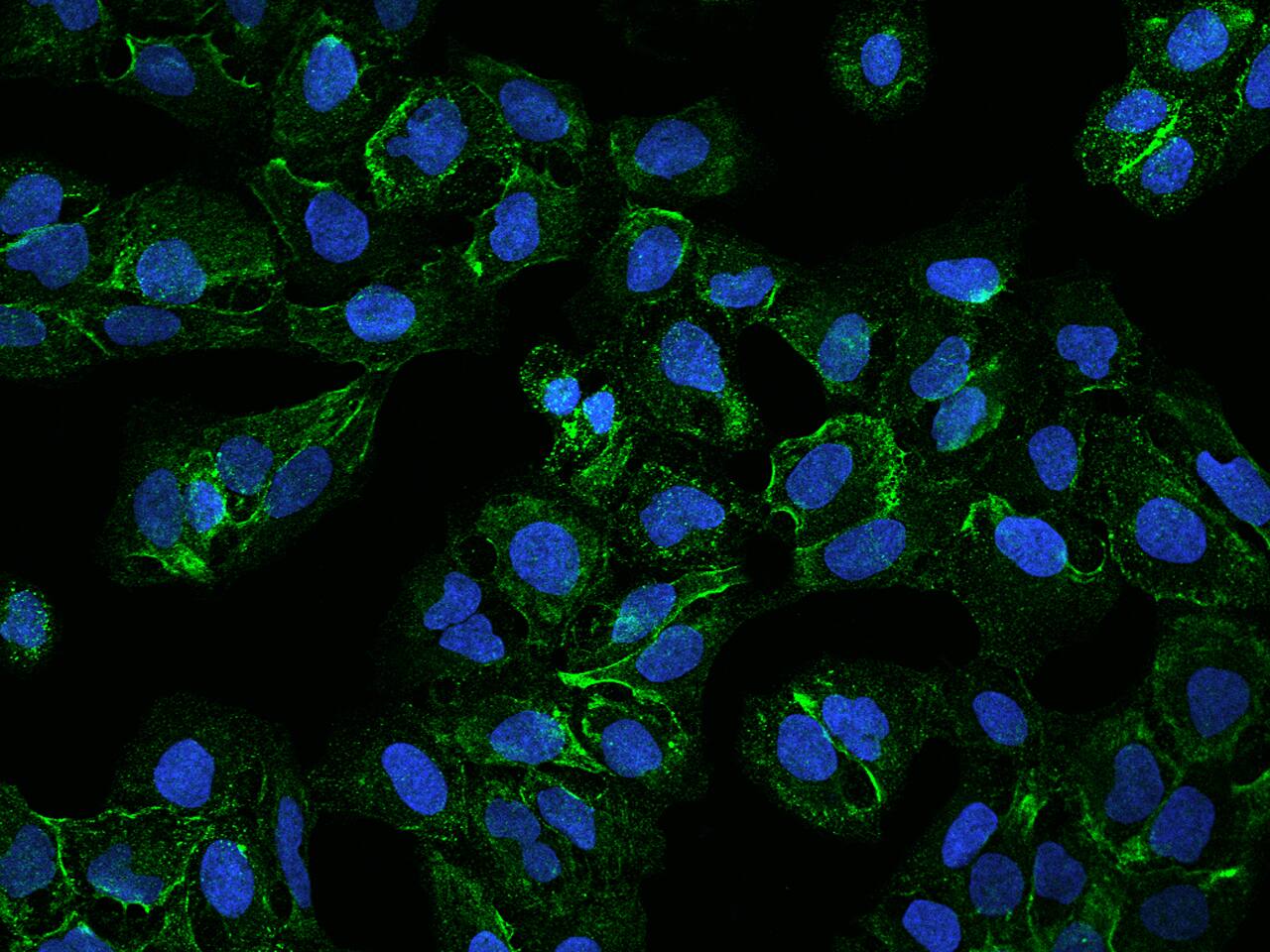 FAM198A Antibody - BSA Free