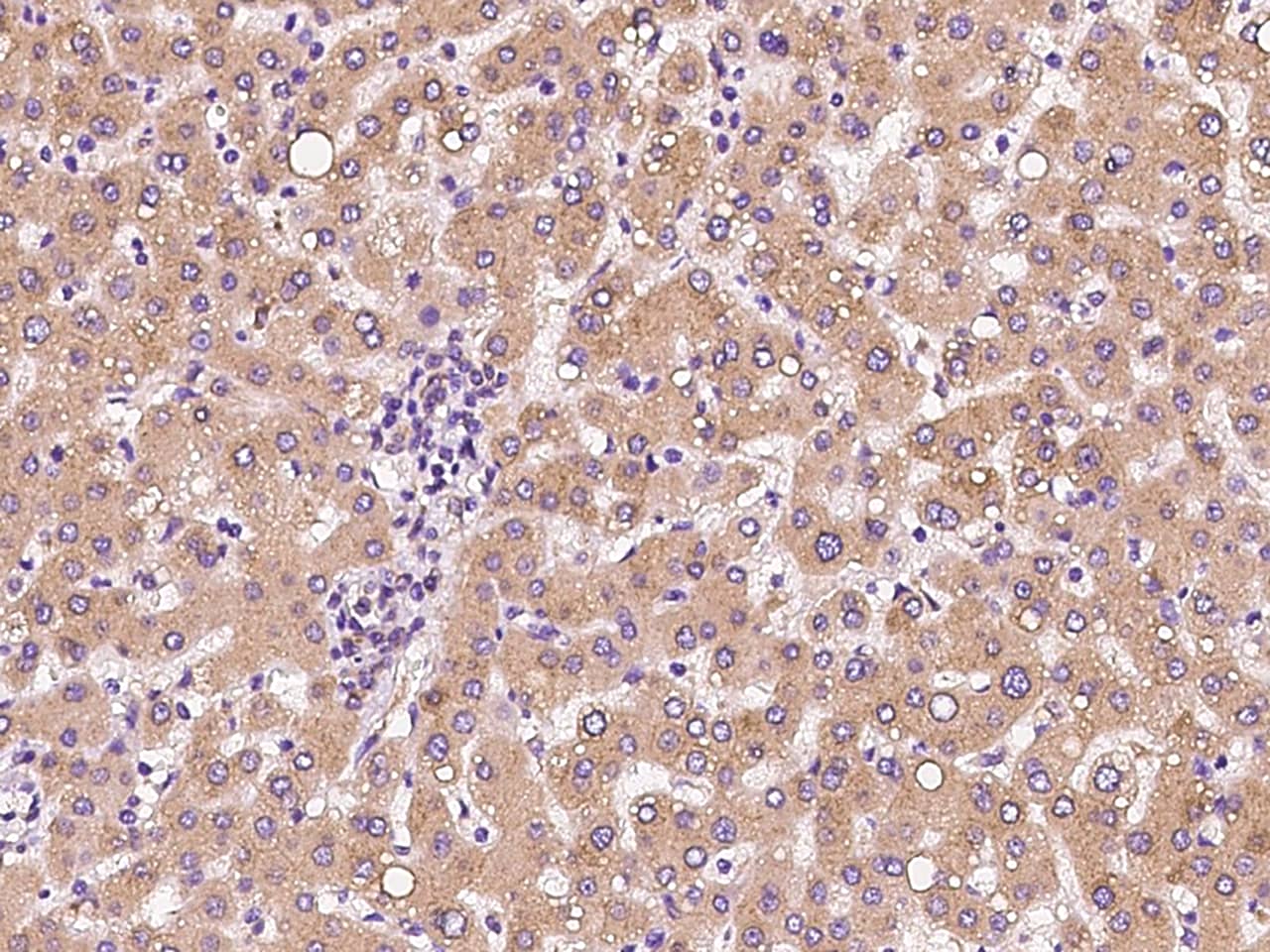 CLCC1 Antibody - BSA Free
