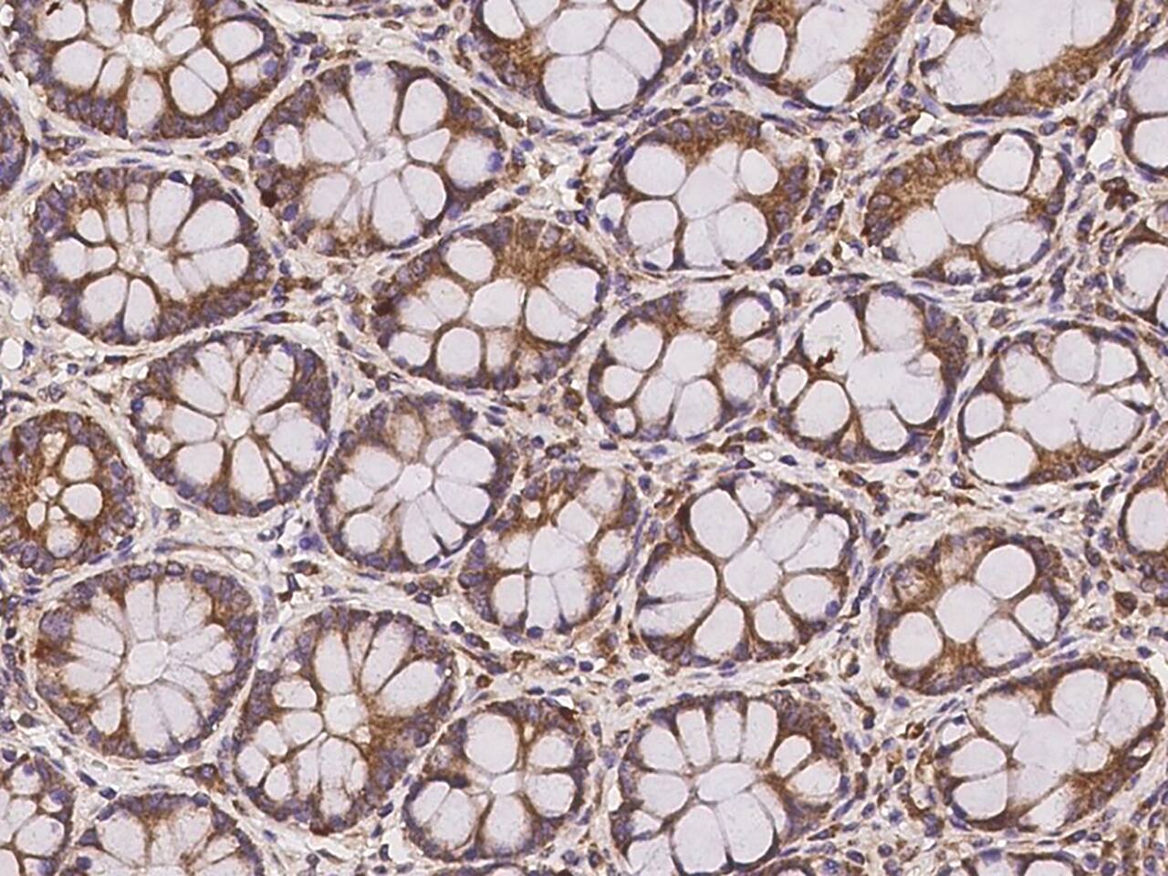 CLUAP1 Antibody - BSA Free