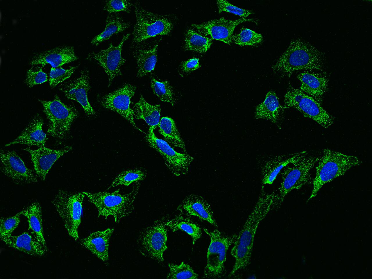 ANKH Antibody - BSA Free