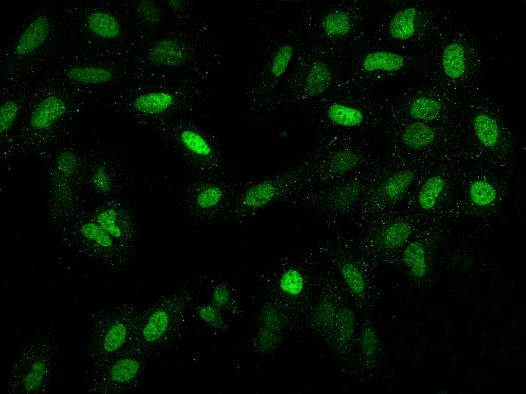 LAF4 Antibody - BSA Free