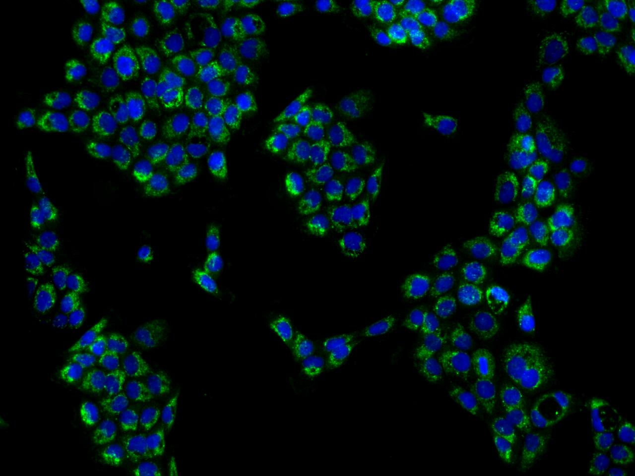 KHDC1 Antibody - BSA Free