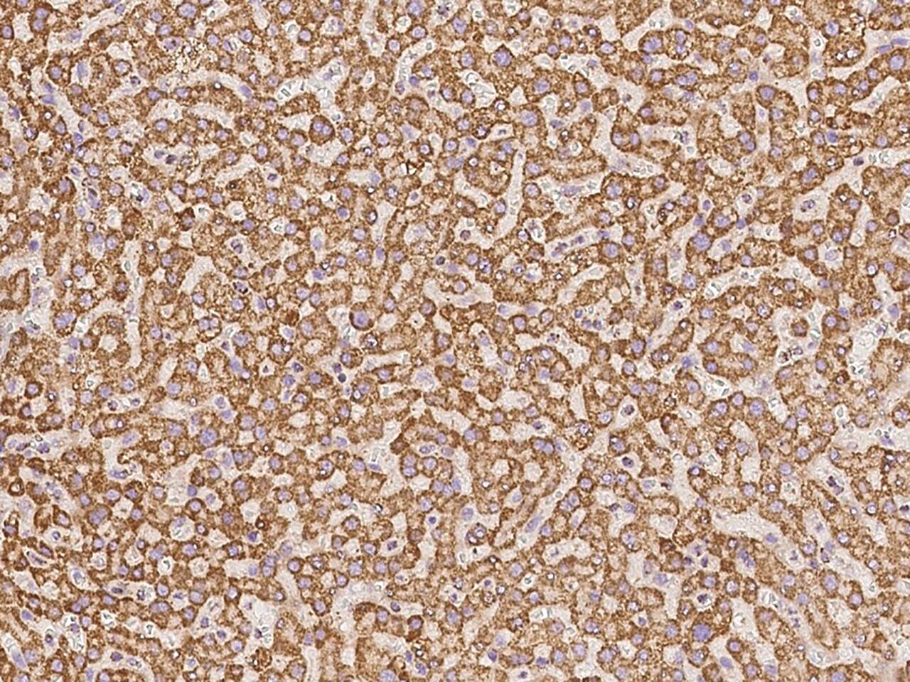 CLPP Antibody - BSA Free