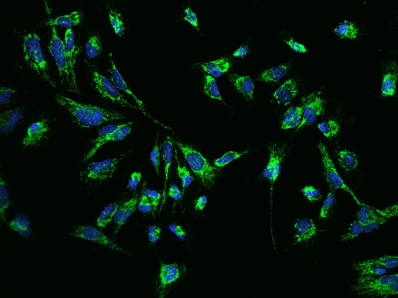 CLPP Antibody - BSA Free