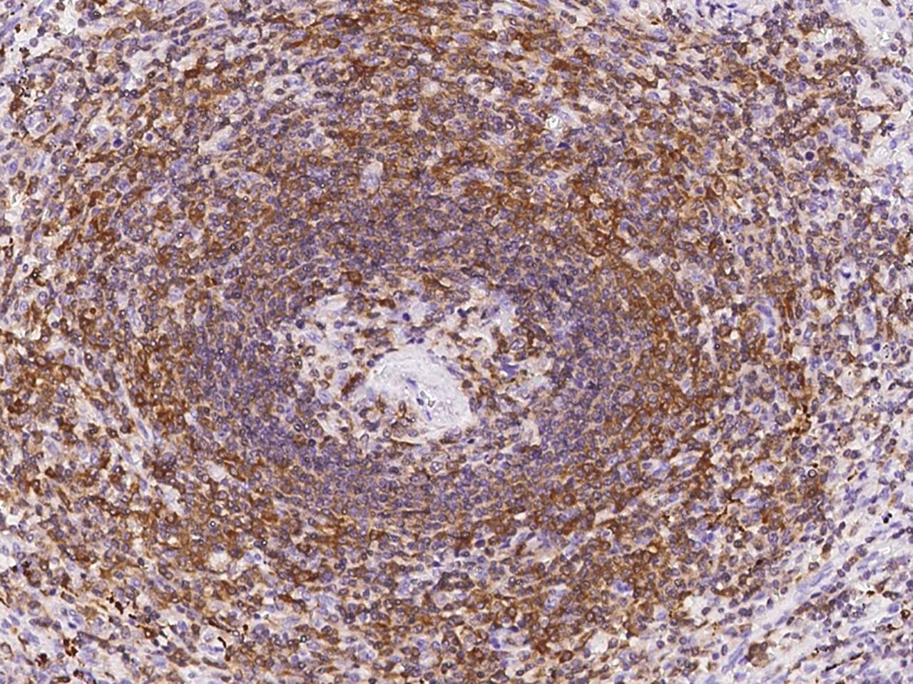 Leupaxin Antibody - BSA Free