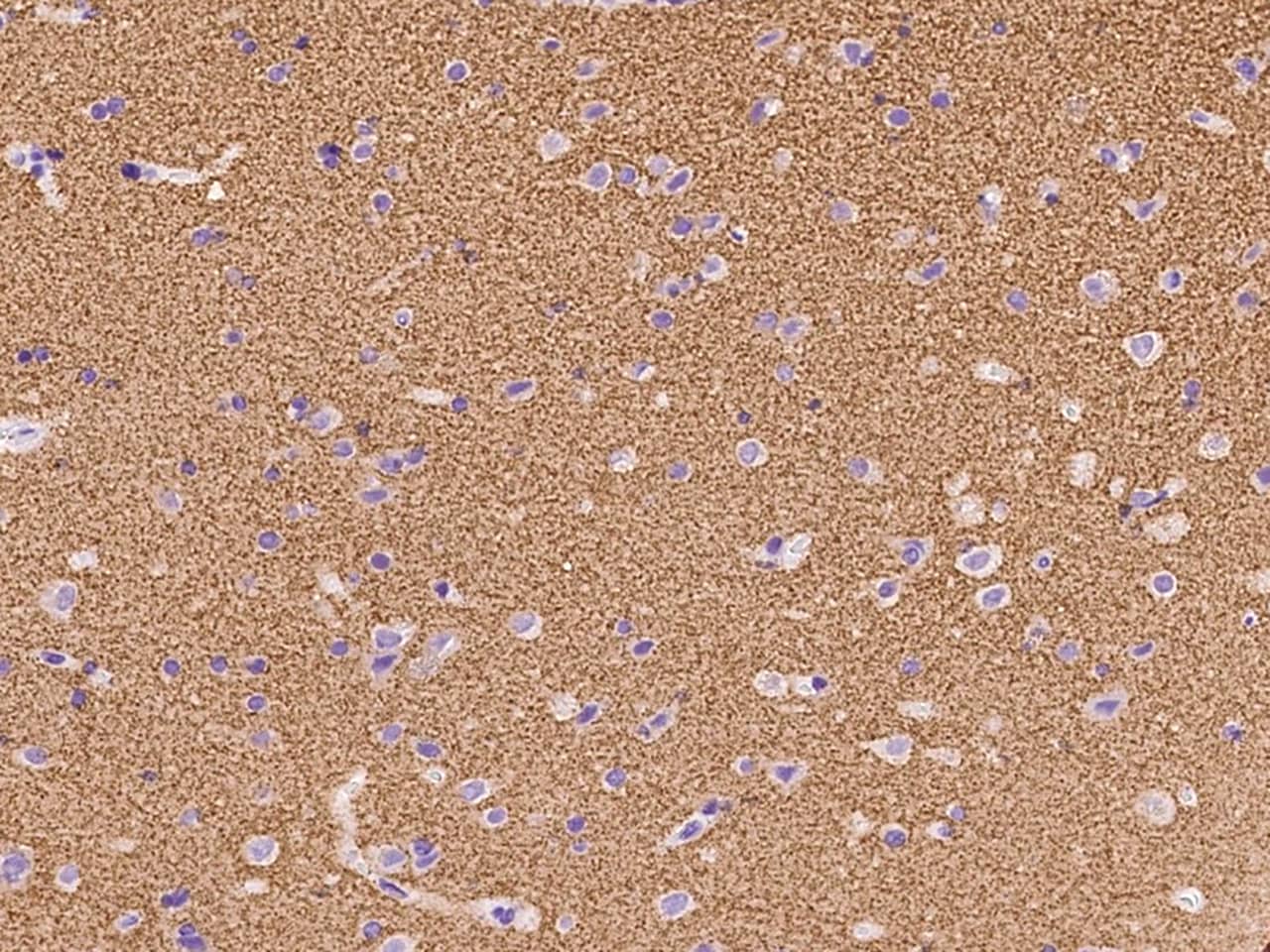 Synaptogyrin 1 Antibody - BSA Free