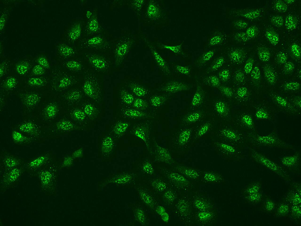 EI2BL Antibody - BSA Free