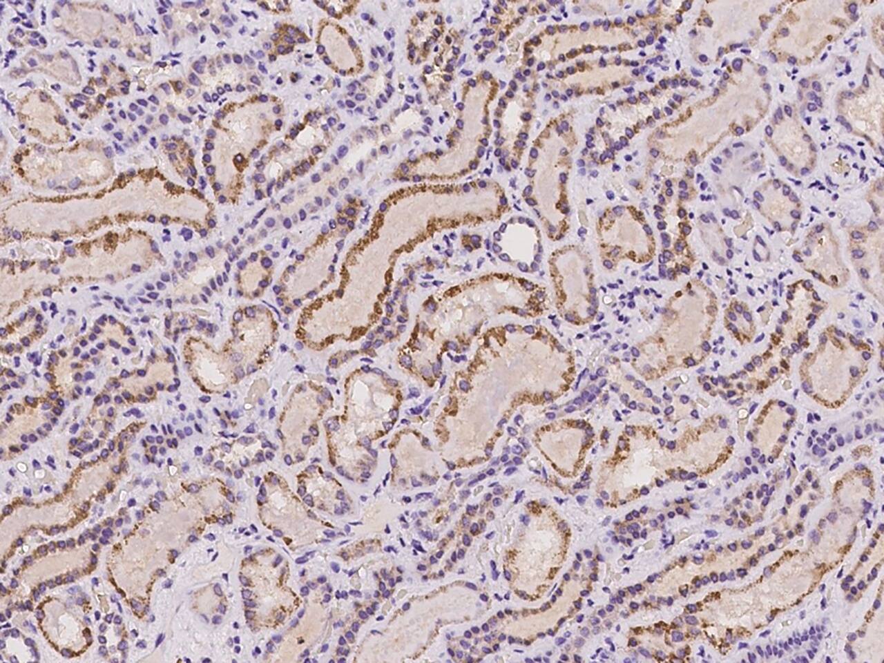 ACAA2 Antibody - BSA Free