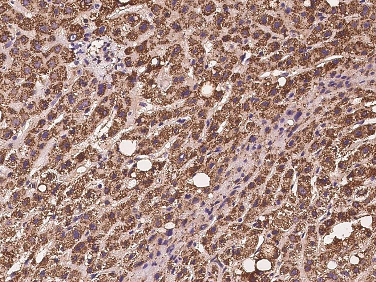 ACAA2 Antibody - BSA Free