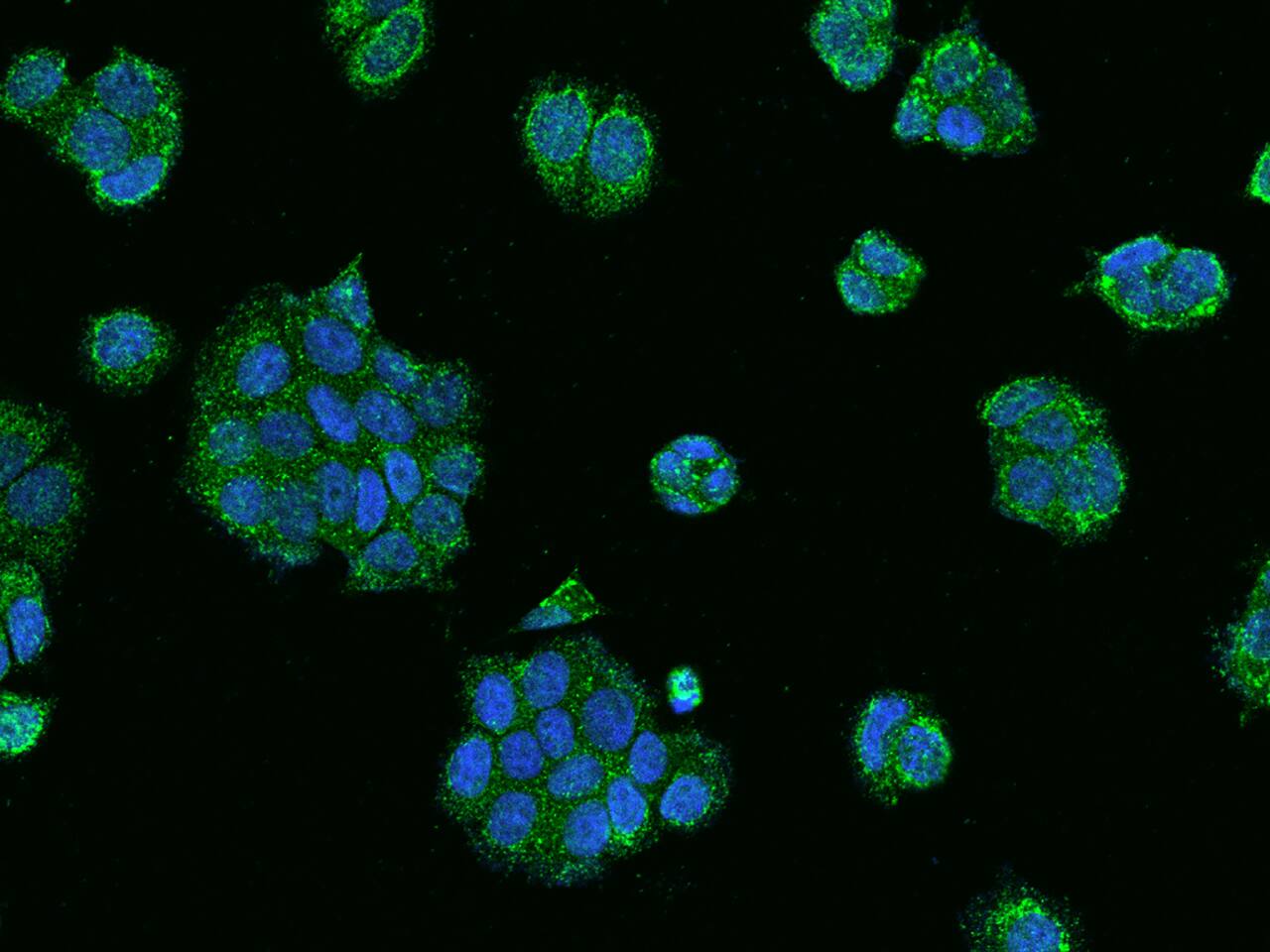 RABEP2 Antibody - BSA Free