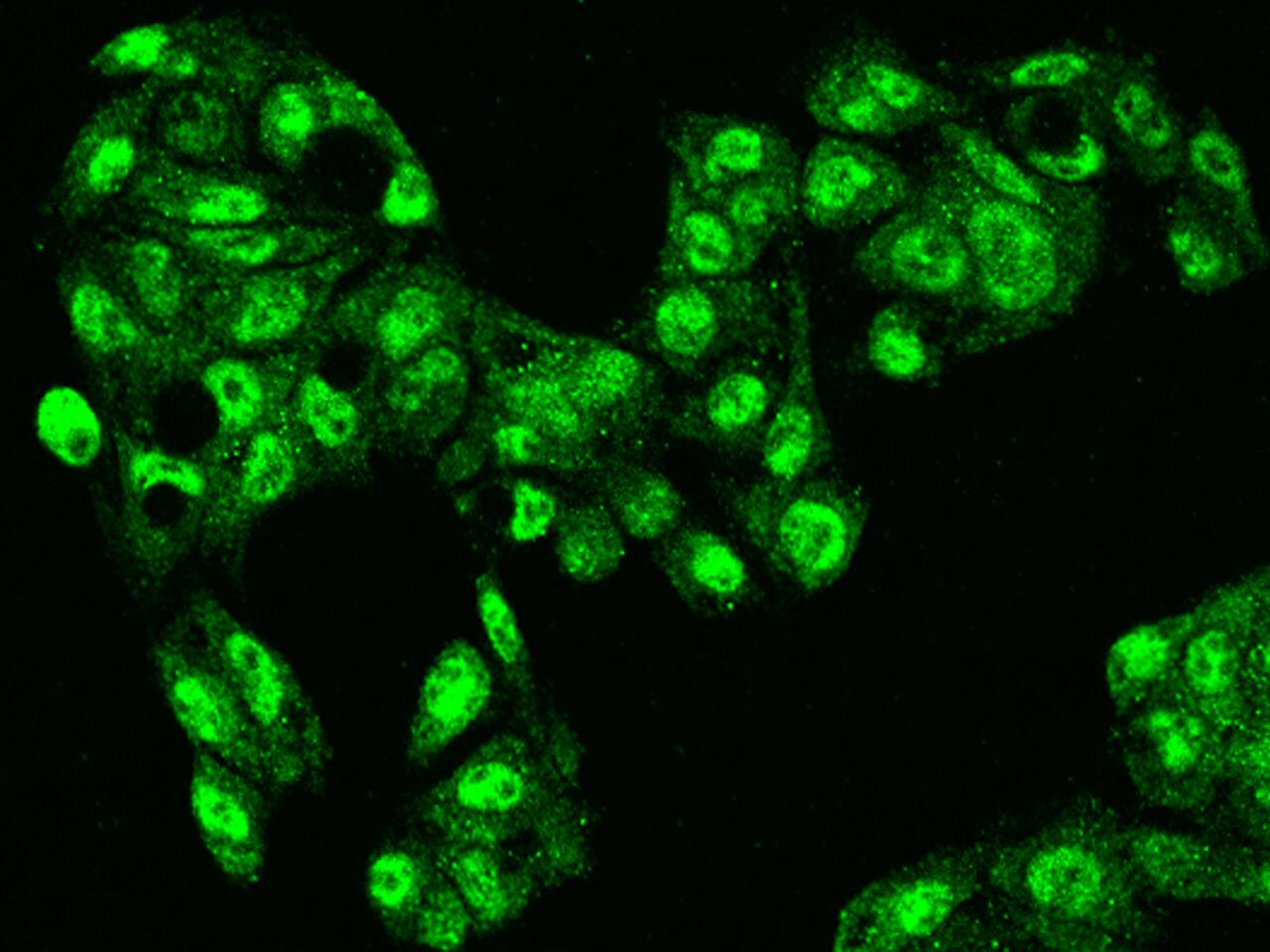 NUDCD2 Antibody - BSA Free
