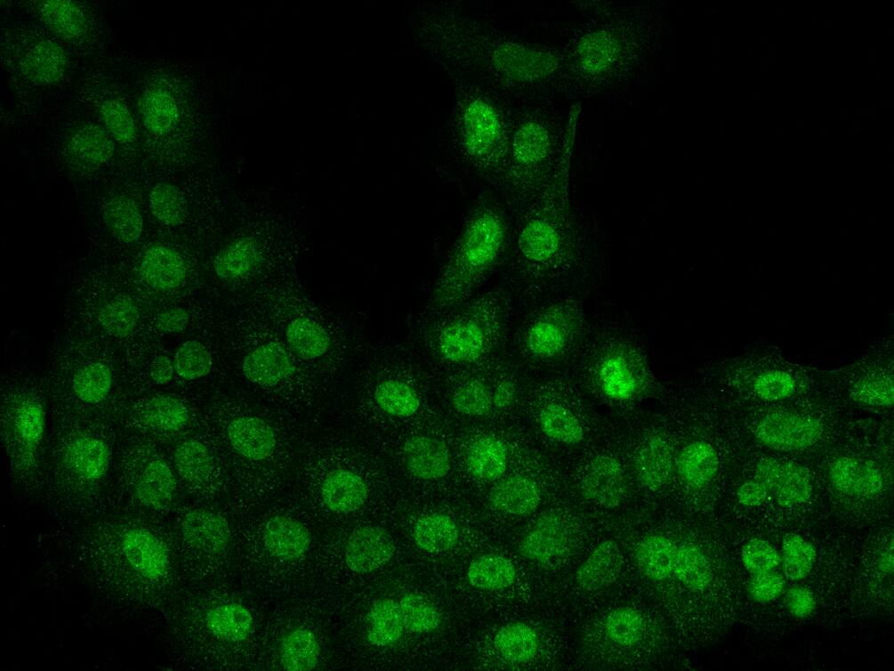 SET1B Antibody - BSA Free