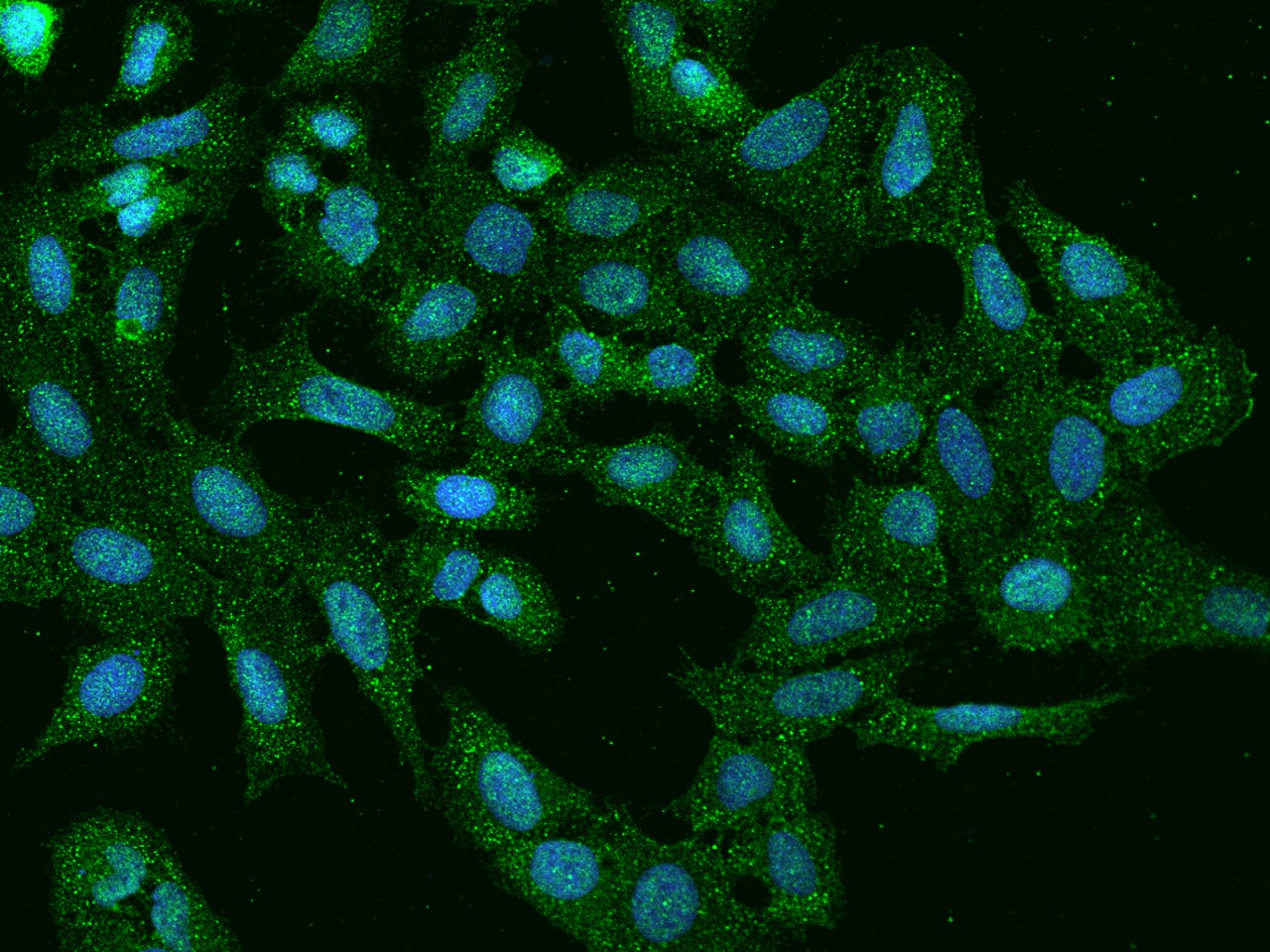 PLEKHH2 Antibody - BSA Free