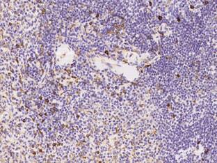 TNFAIP8 Antibody (01) - Azide and BSA Free