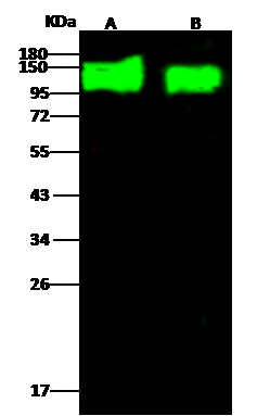 HIV-1 gp120 Antibody