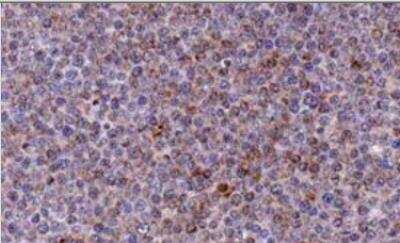 Noxa Antibody (114C307.1R) - BSA Free