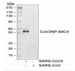 SARS-CoV-2 Nucleocapsid Antibody (84C4a)