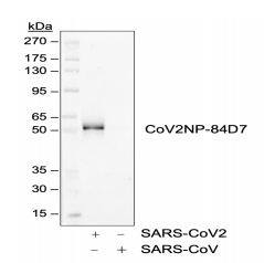 SARS-CoV-2 Nucleocapsid Antibody (84D7)