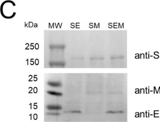 SARS-CoV-2 Membrane Protein Antibody - BSA Free