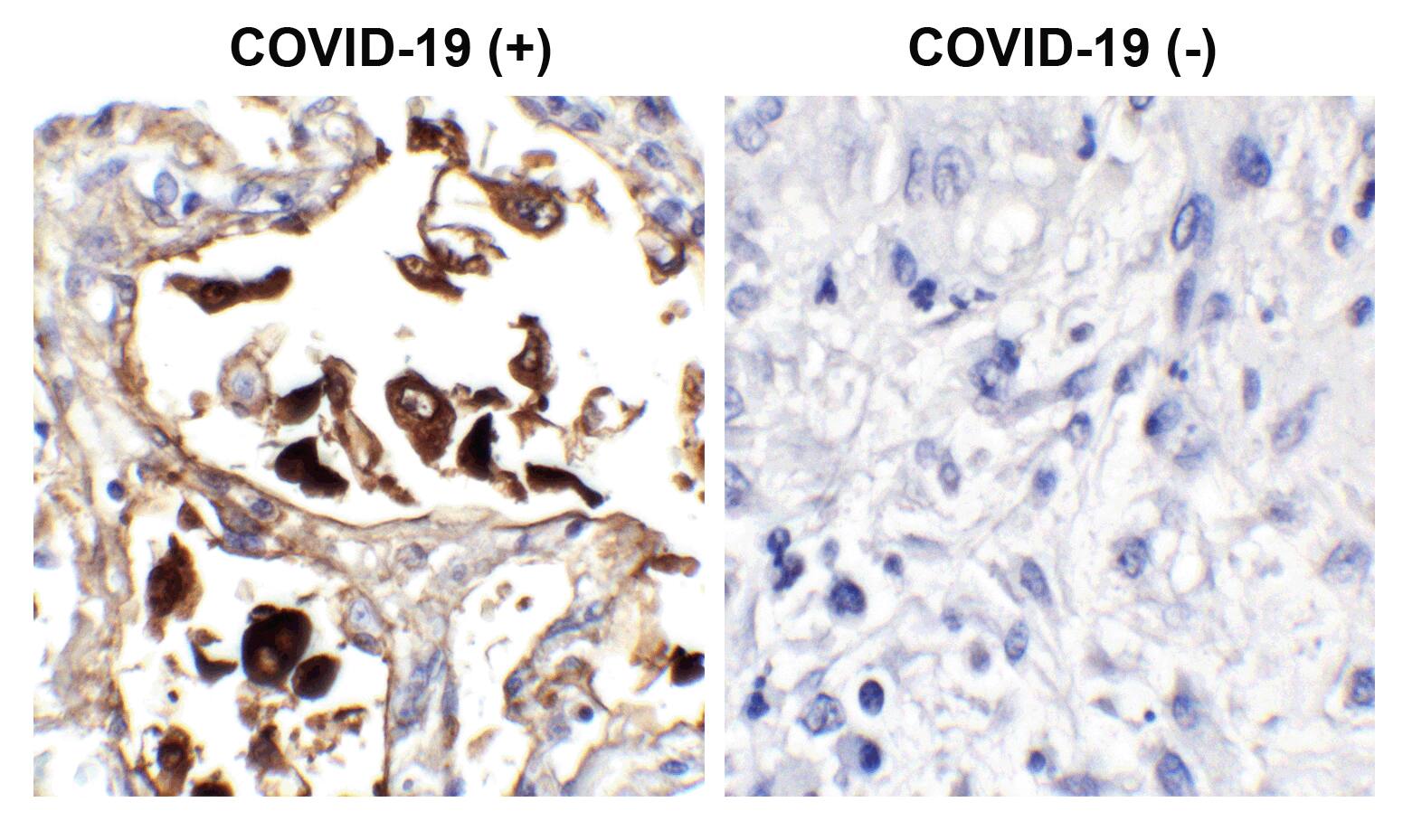 SARS-CoV-2 Nucleocapsid Antibody (NP642) - Azide and BSA Free