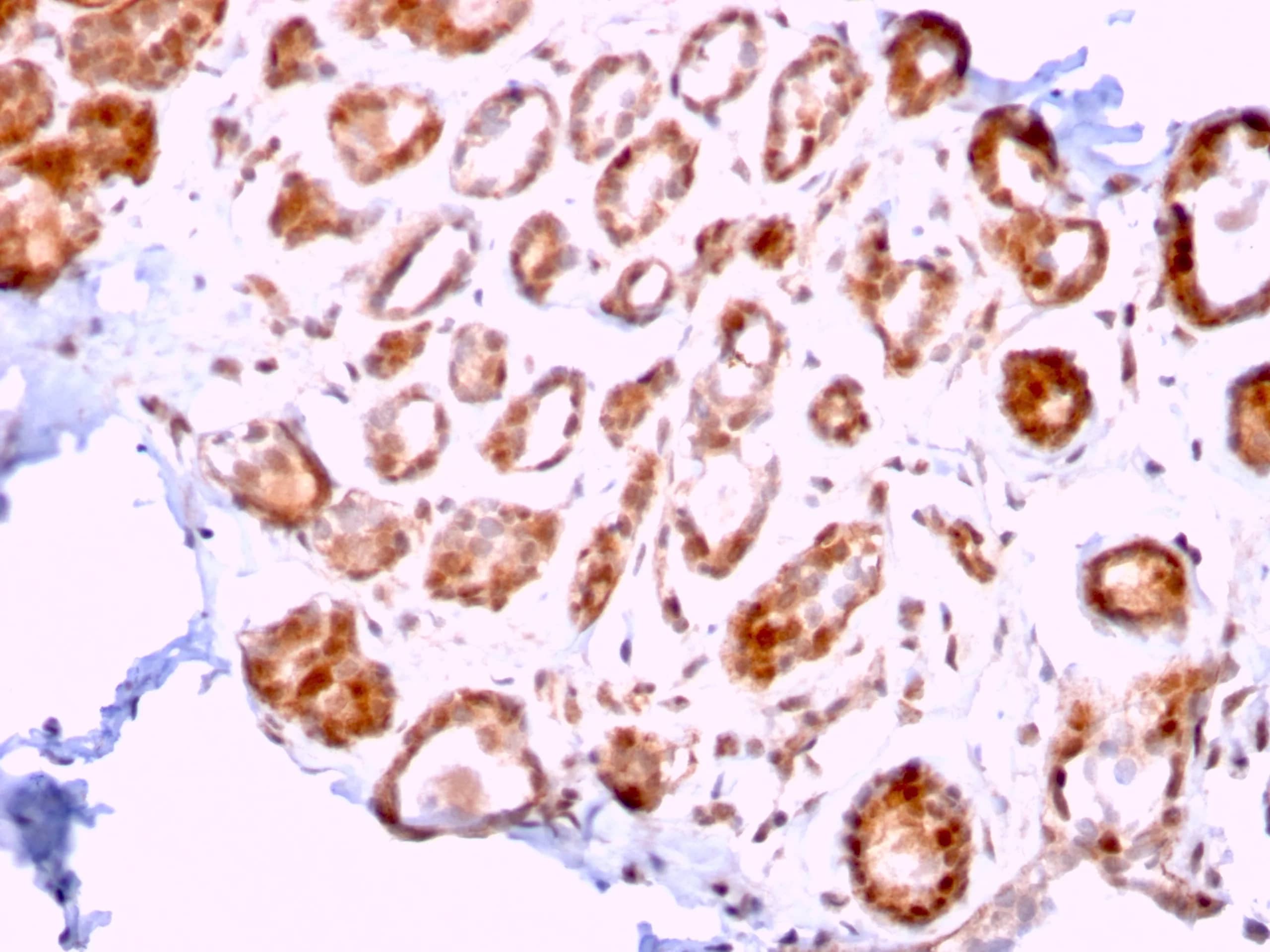 ERCC1 Antibody (ERCC1/2318) Immunohistochemistry-Paraffin: ERCC1 Antibody (ERCC1/2318) [NBP3-07161] -