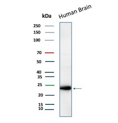 LMO2 Antibody (LMO2/3147R) Western Blot: LMO2 Antibody (LMO2/3147R) [NBP3-07201] -