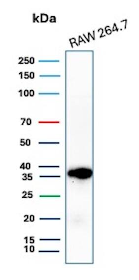 Cyclin D1 Antibody (CCND1/3370R) Western Blot: Cyclin D1 Antibody (CCND1/3370R) [NBP3-07209] -