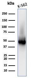 WT1 Antibody (WT1/3477R)