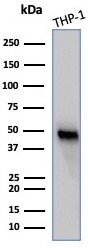 WT1 Antibody (WT1/3477R)