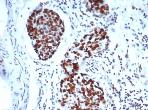 WT1 Antibody (WT1/3477R)