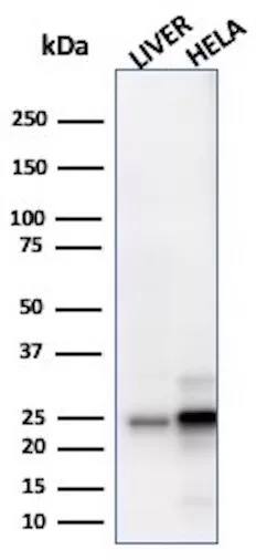 GSTM3 Antibody (CPTC-GSTMu3-1) Western Blot: GSTM3 Antibody (CPTC-GSTMu3-1) [NBP3-07347] -