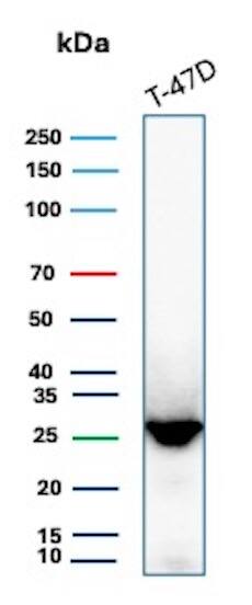 GSTM3 Antibody (CPTC-GSTMu3-1) Western Blot: GSTM3 Antibody (CPTC-GSTMu3-1) [NBP3-07347] -