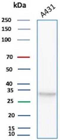 bcl-x Antibody (BCL2L1/1762) Western Blot: bcl-x Antibody (BCL2L1/1762) [NBP3-07416] -