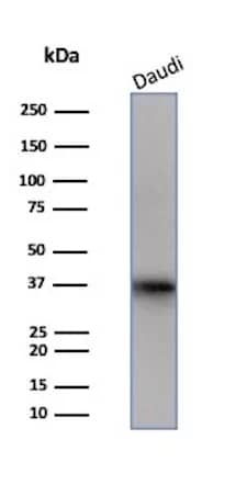 FLI1 Antibody (FLI1/3183) Western Blot: FLI1 Antibody (FLI1/3183) [NBP3-07428] -