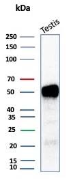 Inhibin alpha Antibody (INHA/1168) Western Blot: Inhibin alpha Antibody (INHA/1168) [NBP3-07433] -