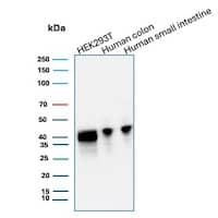 CDX2 Antibody (CDX2/2951R) Western Blot: CDX2 Antibody (CDX2/2951R) [NBP3-07445] -