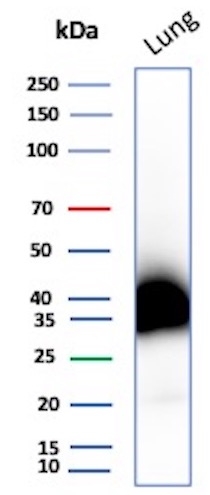 Podoplanin Antibody (PDPN/4009R) Western Blot: Podoplanin Antibody (PDPN/4009R) [NBP3-07494] -