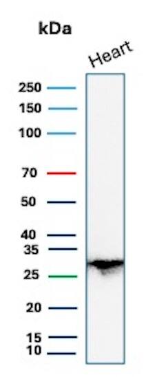 PDLIM1 Antibody (CPTC-PDLIM1-1) Western Blot: PDLIM1 Antibody (CPTC-PDLIM1-1) [NBP3-07518] -