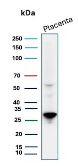 PDLIM1 Antibody (CPTC-PDLIM1-1) Western Blot: PDLIM1 Antibody (CPTC-PDLIM1-1) [NBP3-07518] -