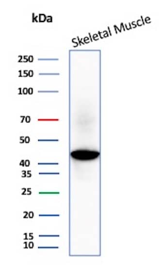 Creatine Kinase, Muscle/CKMM Antibody (CKMM/3341) Western Blot: Creatine Kinase, Muscle/CKMM Antibody (CKMM/3341) [NBP3-07560] -