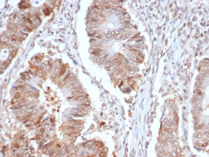 RRM1 Antibody (RRM1/4372R)