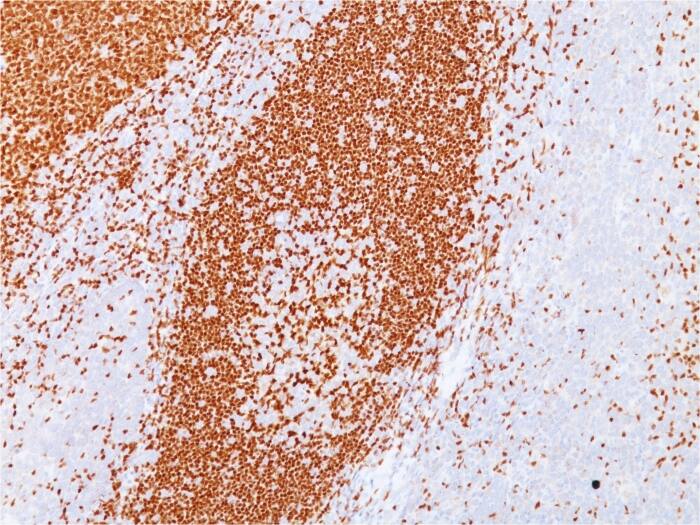 Pax5/BSAP Antibody (PAX5/3735) Immunohistochemistry-Paraffin: Pax5/BSAP Antibody (PAX5/3735) [NBP3-07581] -