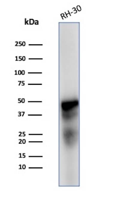 Desmin Antibody (DES/2960R) Western Blot: Desmin Antibody (DES/2960R) [NBP3-07640] -