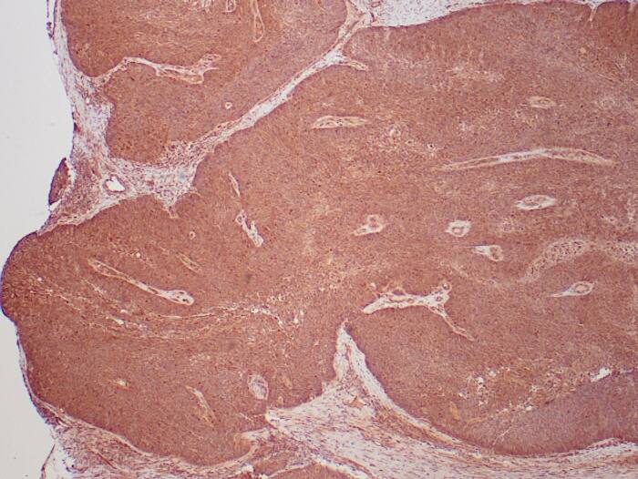 HPV16/HPV18 E6 Antibody (HPV16/1295 + HPV18/1297) HPV16/HPV18 E6 Antibody (HPV16/1295 + HPV18/1297) - Azide and BSA Free